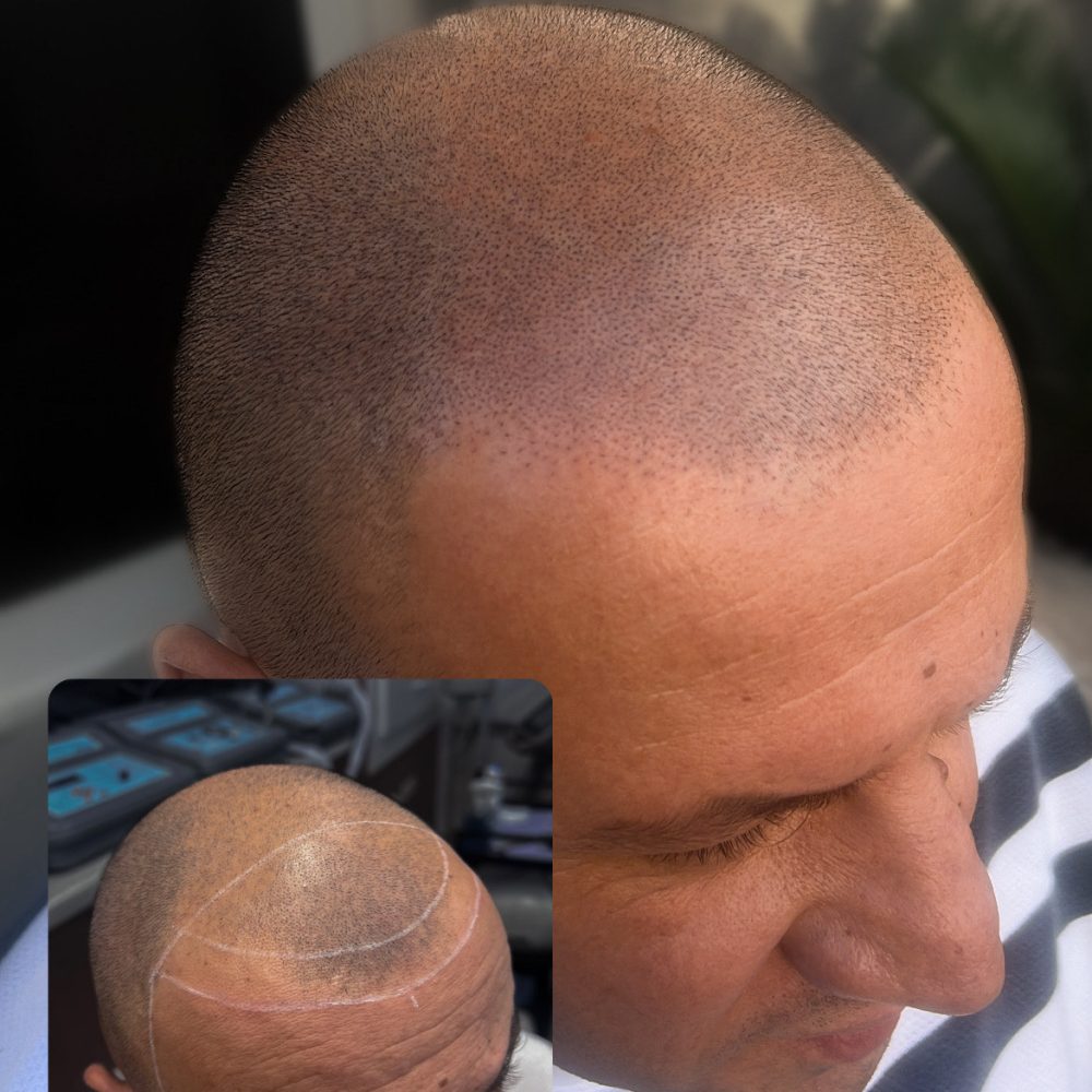 9CB503E3-7E2E-44D4-A9D4-21824D57DAF9